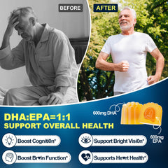 Gummies with turmeric, MSM, and glucosamine for mobility support