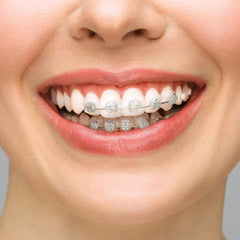 BVN Braces Wax bundle image showing multiple boxes