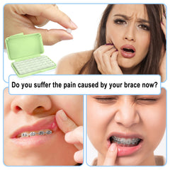 Instructions on using BVN dental wax for braces