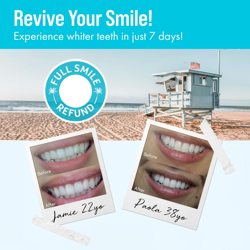 Gel refills compatible with Cali White whitening kits and trays