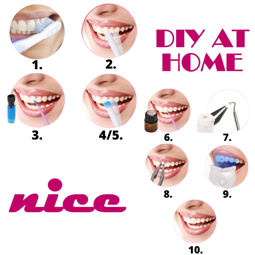 Before application: tooth gems prepared for bonding and sparkle preview