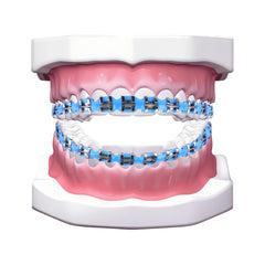 Orthodontic teaching demonstration using clip-on braces.