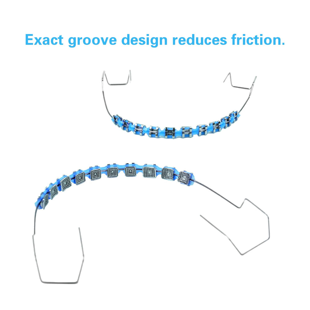 Blue clip-on braces shown with dental mirror.