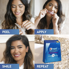 Before and after whitening with Crest 3D Whitestrips Brilliance White