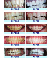 User manual and packaging for Crystal Clear Teeth Whitening Kit