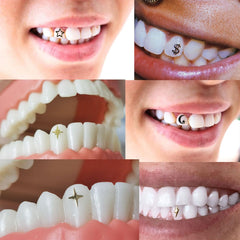 Illustration of the dental gem bonding process