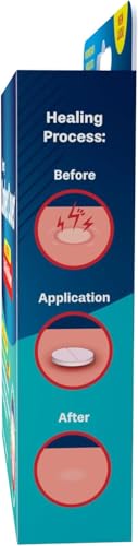 Mint-flavored canker sore tablets in blister pack