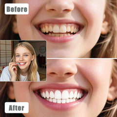 Interdental brushes removing stains between teeth