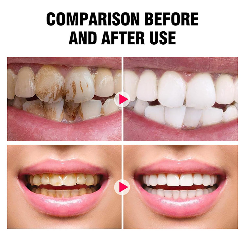 Tooth powder compatible with dental restorations like crowns or veneers