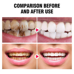 Tooth powder compatible with dental restorations like crowns or veneers