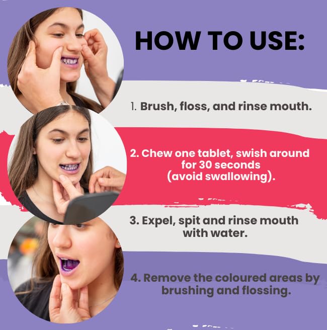 Child brushing teeth with disclosing tablets showing plaque areas