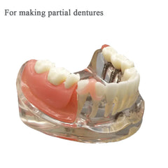 DIY denture gum material improving smile