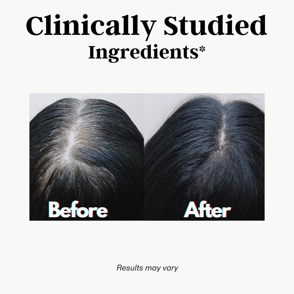 Doctor-formulated hair supplement ingredients