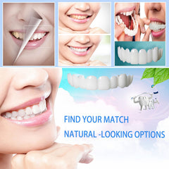 Veneer kit easy to clean and reusable