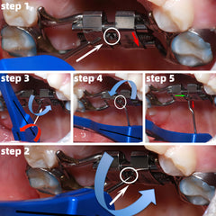 Ergonomic orthodontic expansion tool set