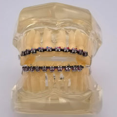 Educational orthodontic kit for teaching dental students and practitioners