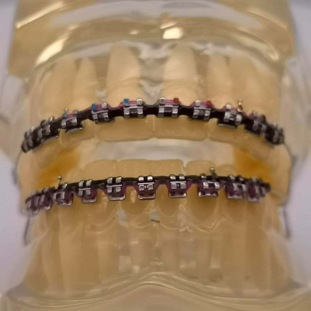 Close-up of two-color braces power chains in No.61 kit