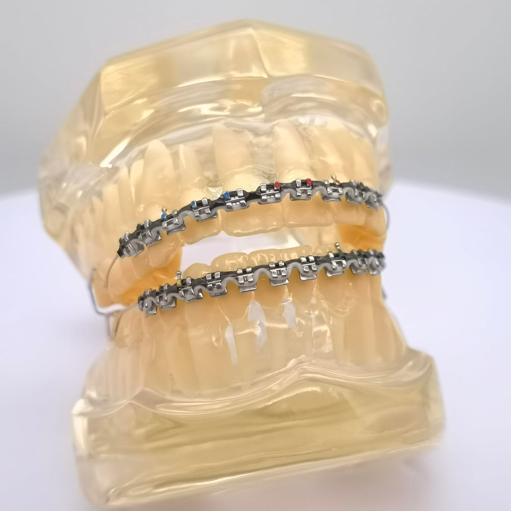 Complete fake braces kit with brackets, wire, and power chains