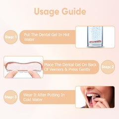 Soft, natural look of SmileShaperVeneers on gums