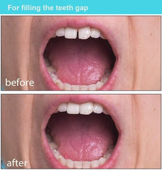 Tooth replacement forming as beads cool and harden