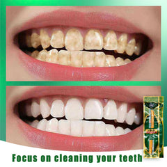 Eco-friendly traditional oral care: Miswak sticks
