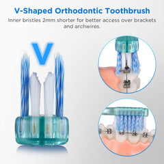Close-up of V-shaped bristles cleaning around brackets