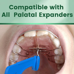 Universal expander keys by Fremouth compatible with multiple palatal expanders