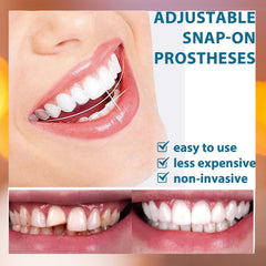 Full denture set designed for upper and lower arches