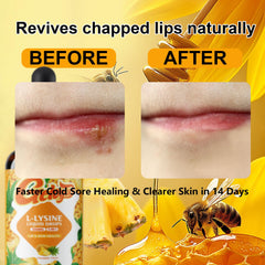 Geloyar L-Lysine Liquid Drops bottle shown with packaging