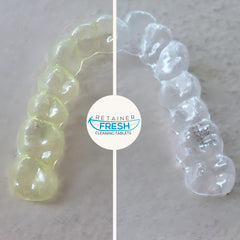 Getting started with Aligners eBook
