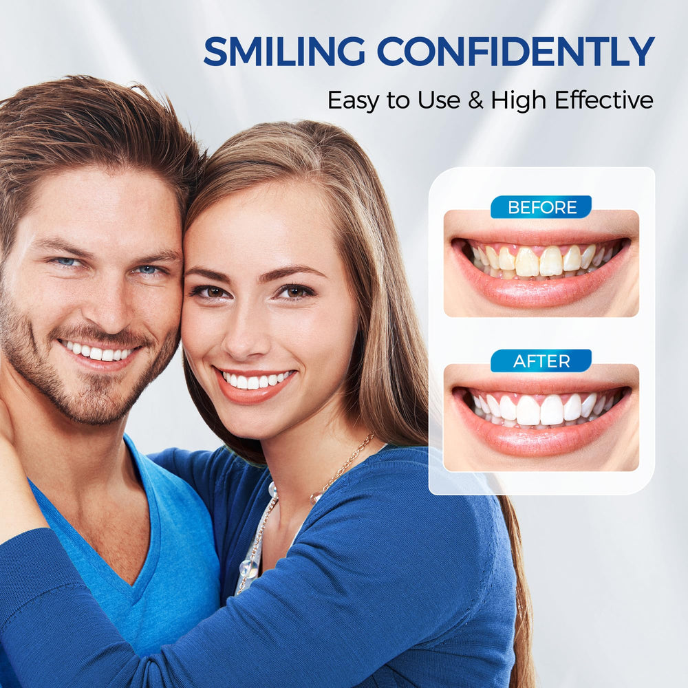 Gift-ready packaging of Teeth Whitening Kit