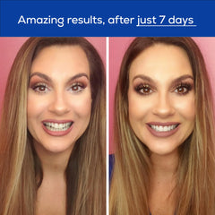 GLO Good Foundation donation image supporting dental care