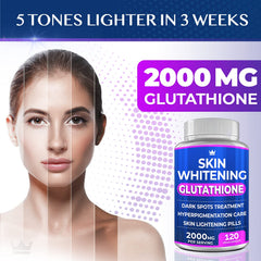 Acne scar remover using Glutathione whitening pills