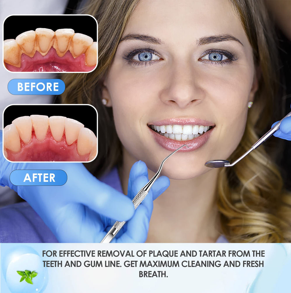 Dental cleaning kit components for at-home care
