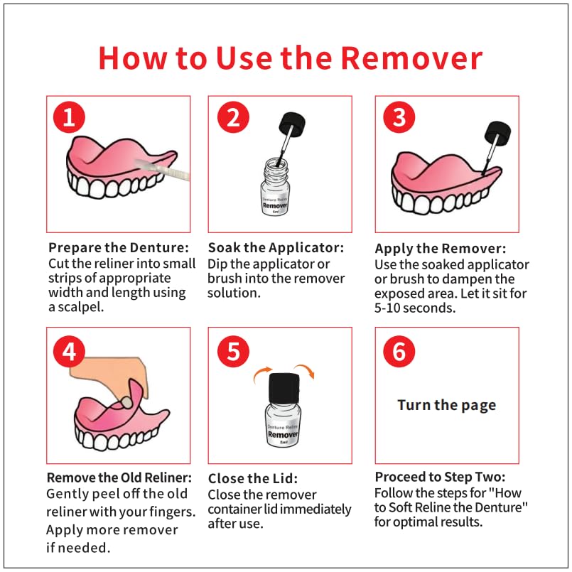 Hand Application of Soft Reline to Dentures