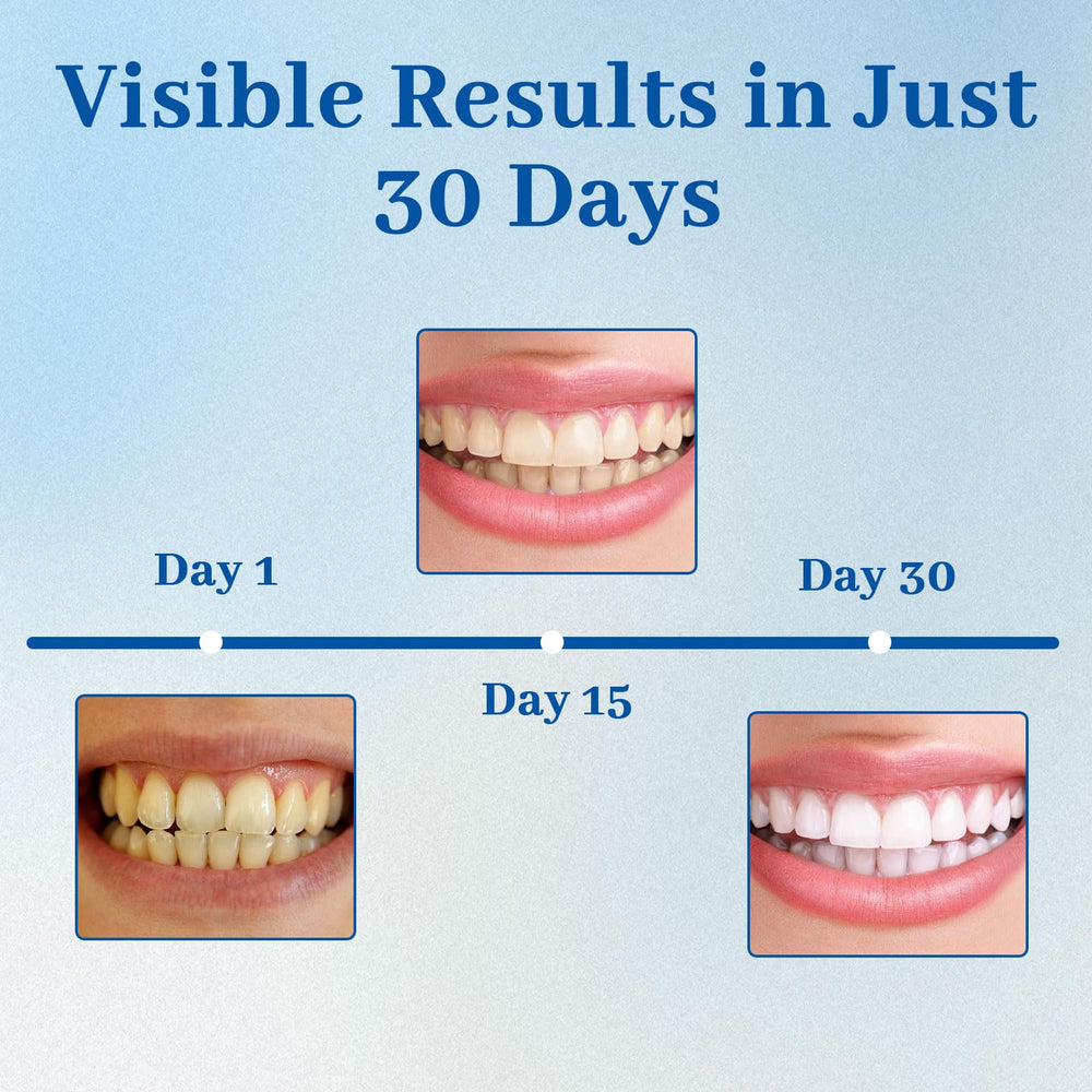 Home dental care application being used on teeth