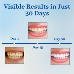 Home dental care application being used on teeth