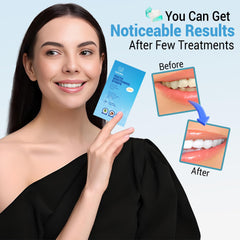 Before and after whitening results with Huzayl Strips