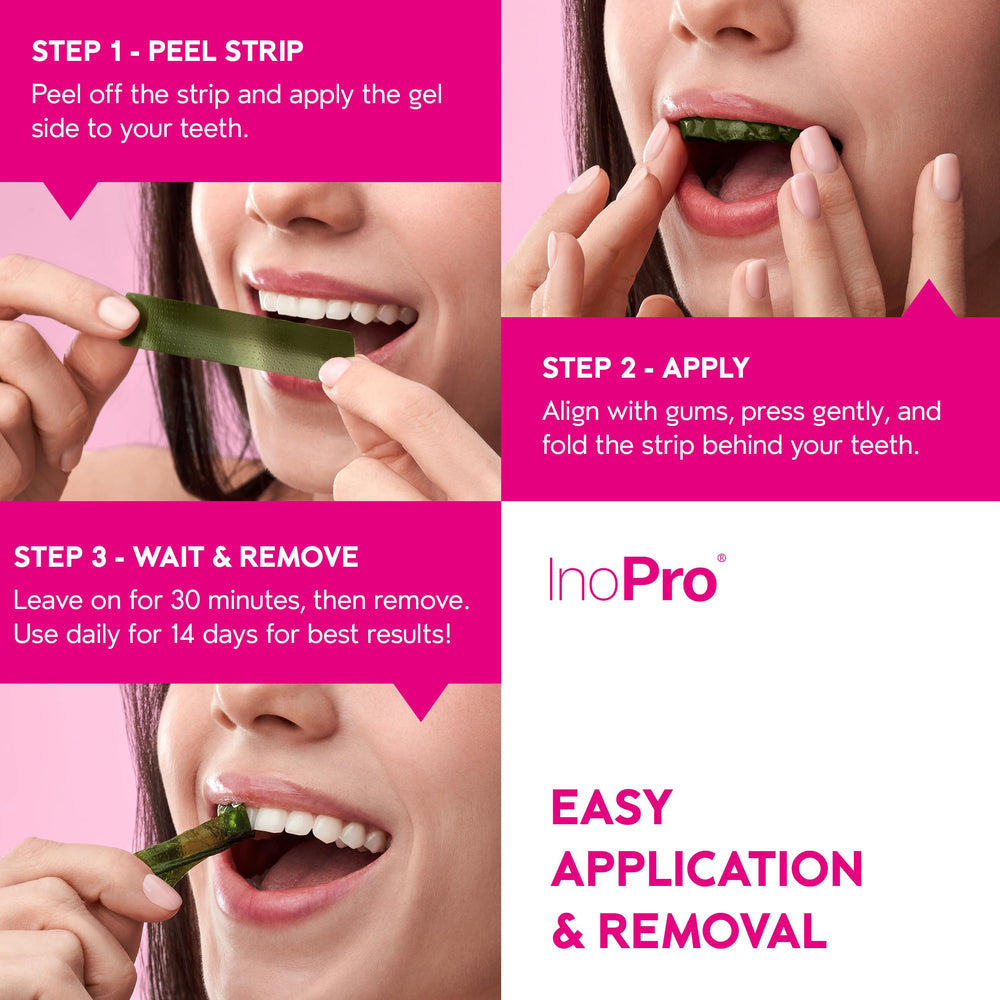 Shade guide included in the InoPro kit