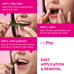 Shade guide included in the InoPro kit
