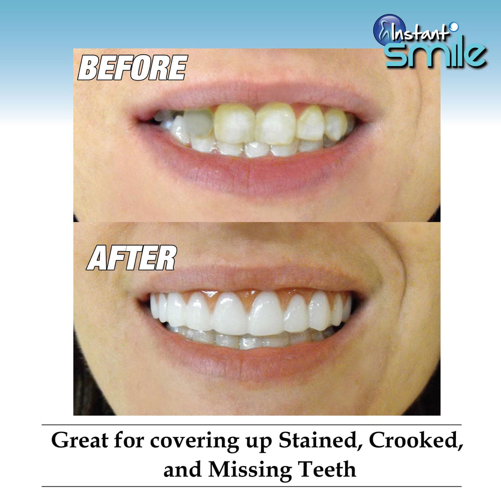 Sizing reference: front four teeth measure about 1 1/8 inch