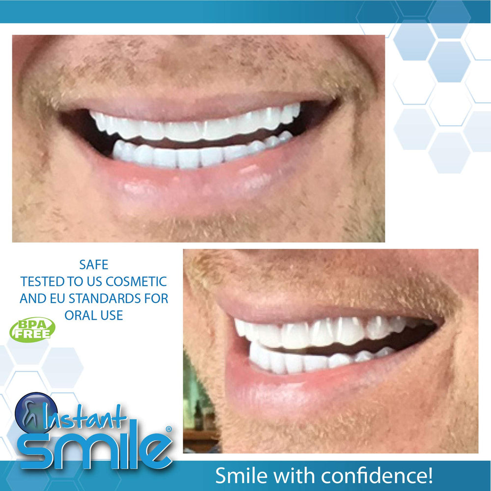 Teeth kit covering missing, broken, and stained teeth with extra fitting material