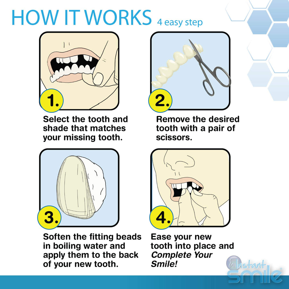 Before and after using Instant Smile temporary tooth replacement