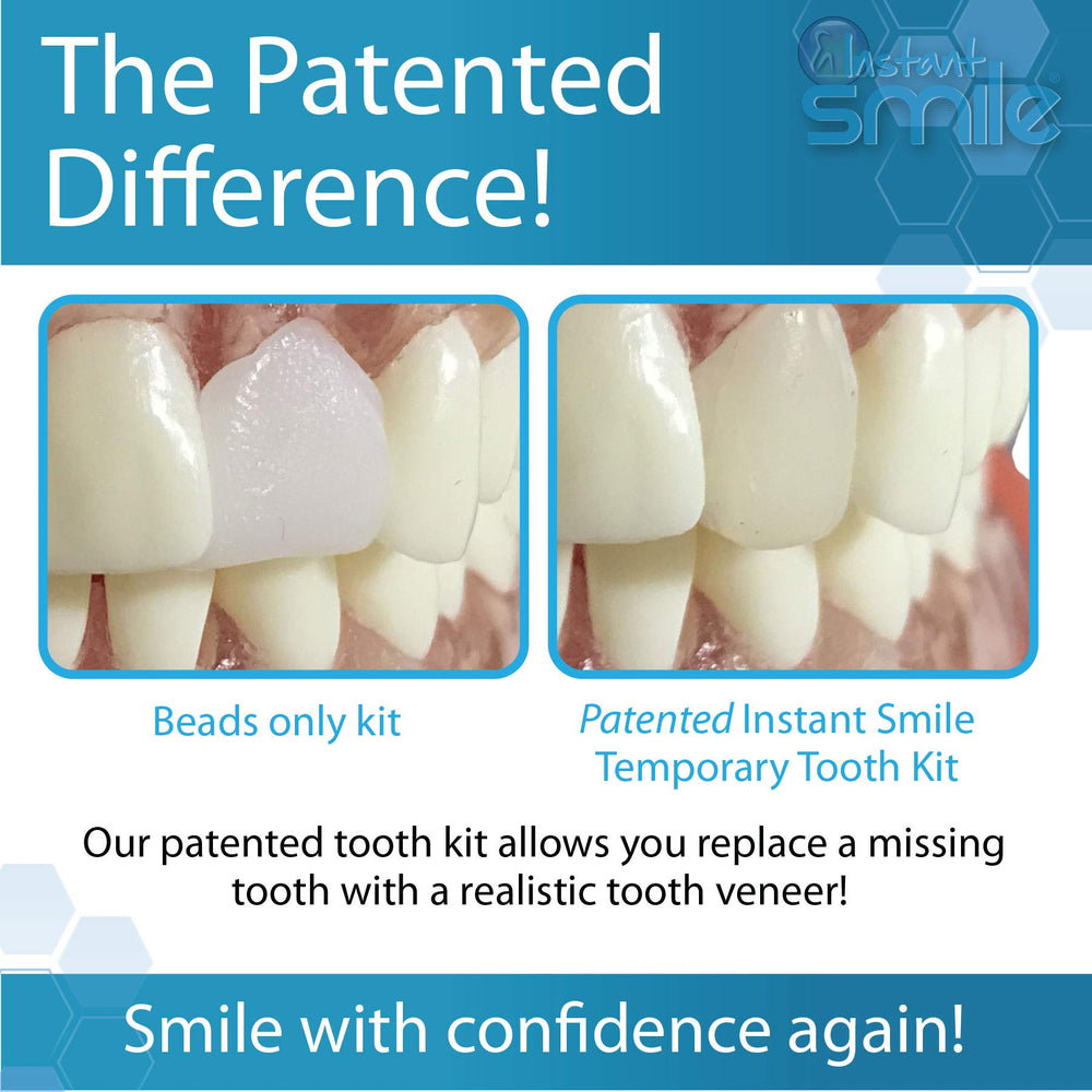 Overview of the Instant Smile kit being applied