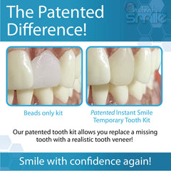 Overview of the Instant Smile kit being applied