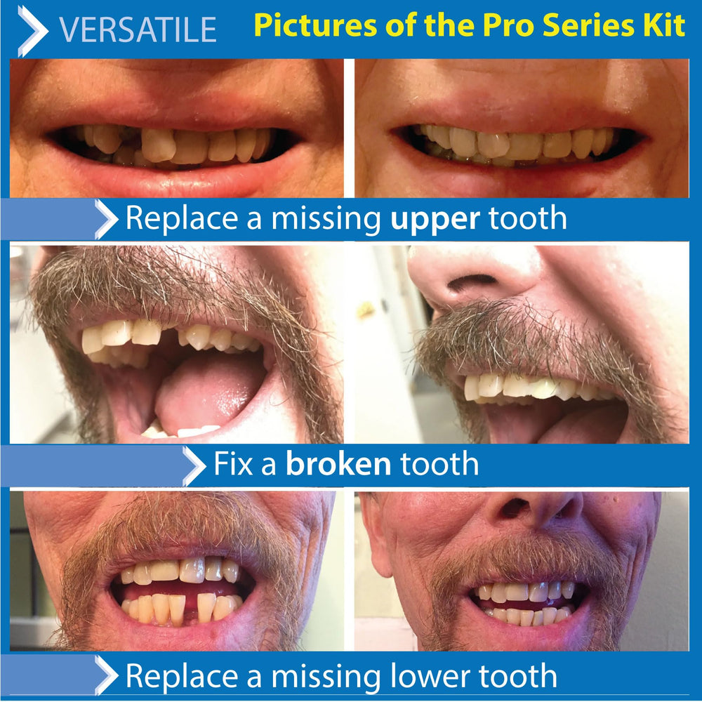 Kit packaging showing contents and extra beads included