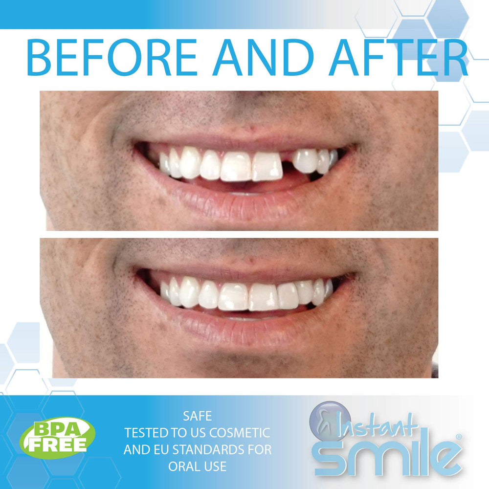 Close-up of fitting beads for tooth replacement