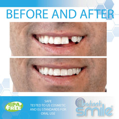 Close-up of fitting beads for tooth replacement