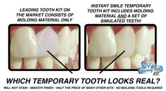 Temporary single-tooth replacement for upper or lower jaw