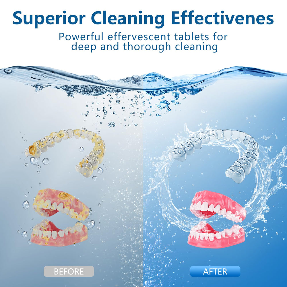 Invisalign and dental appliance cleaning with tablets